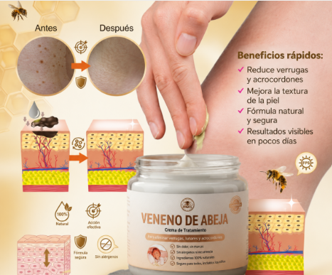Bee Crema Cosmética con Veneno de Abeja Para la eliminación de verrugas, lunares y manchas en la piel. ¡Envío gratis!